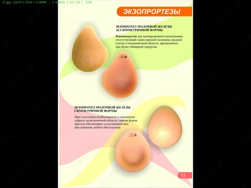 Экзопротез молочной железы 