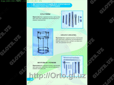 Аппарат Илизарова