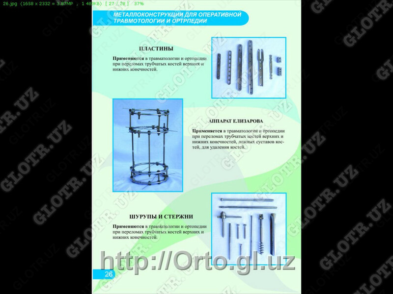 Аппарат Илизарова