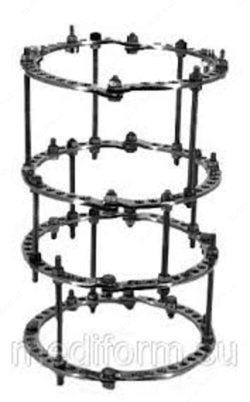 Аппарат Илизарова