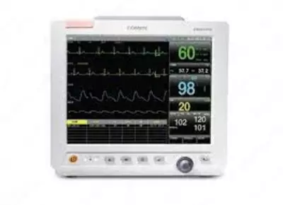 Прикроватный монитор пациента STAR8000A (COMEN, КНР)