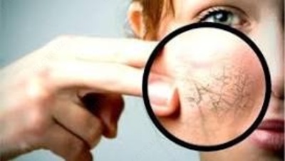 tirnoq va boshqalar kasalliklari.