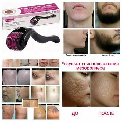 Dermaroller Mezoroller