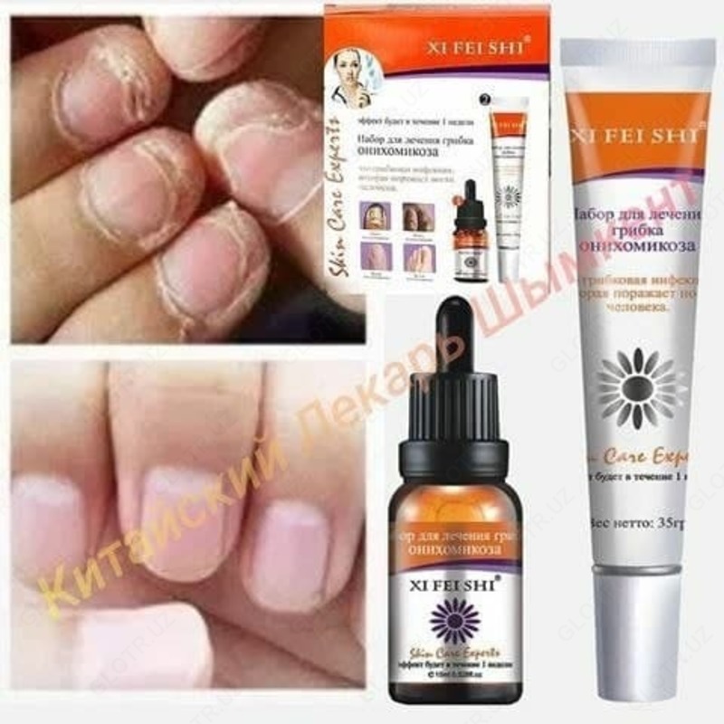  Набор для лечения грибка онихомикоза XI FEI SHI - 