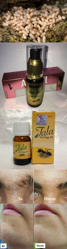 Муравейная масло Ant oil от HEMANI купить в Ташкенте - 99 000 сум