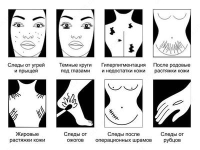 крем Призтин купить Ташкенте