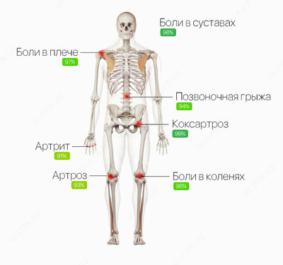 Крем Artrofast Артрофаст для массажа тела в области суставов купить в Ташкенте
