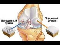   Корал Босвеллия Коралловый клуб от суставных проблемах купить в Ташкенте