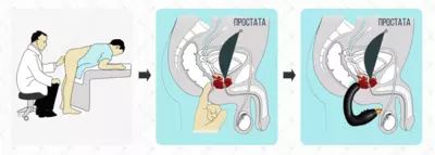Урологический массажёр для простаты PROSTATA HELP MP-1 купить в Ташкенте