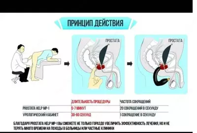 Урологический массажёр для простаты PROSTATA HELP MP-1 купить в Ташкенте
