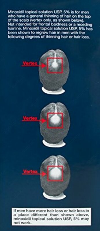 Миноксидил 5% Киркланд (Minoxidil) лосьоны для волос и бороды - 110 000 сум
