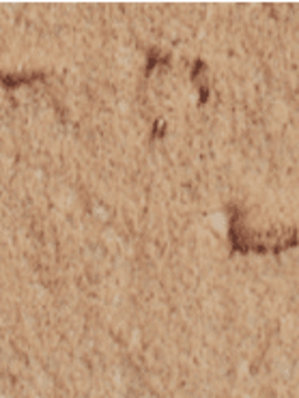 Strukturaviy gips Maru dekor pardasi 25 kg Rangli MC-032