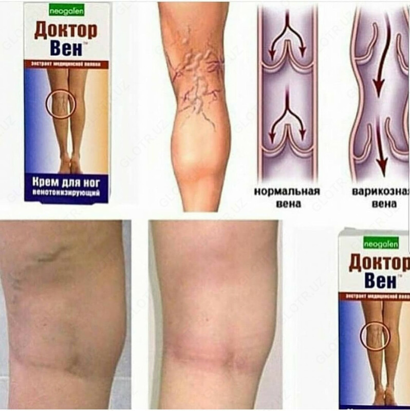 Крем для ног Доктор Вен