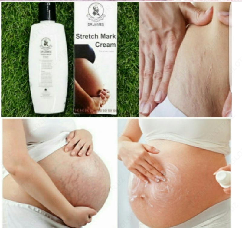 DR. JAMES STRETCH MARK CREAM / КРЕМ ДЛЯ УСТРАНЕНИЯ РАСТЯЖЕК ДОКТОР ДЖЕЙМС (200 МЛ)