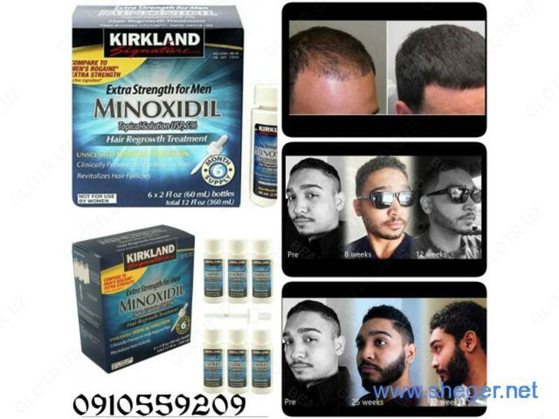 135 000 so'm Kirkland minoxidil 5%