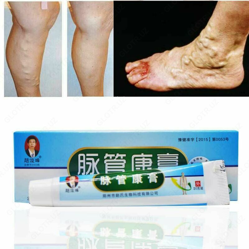 Varikoz tomirlari uchun malham - 120 000 so'm