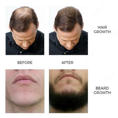 Цинк витамин для волос и бороды