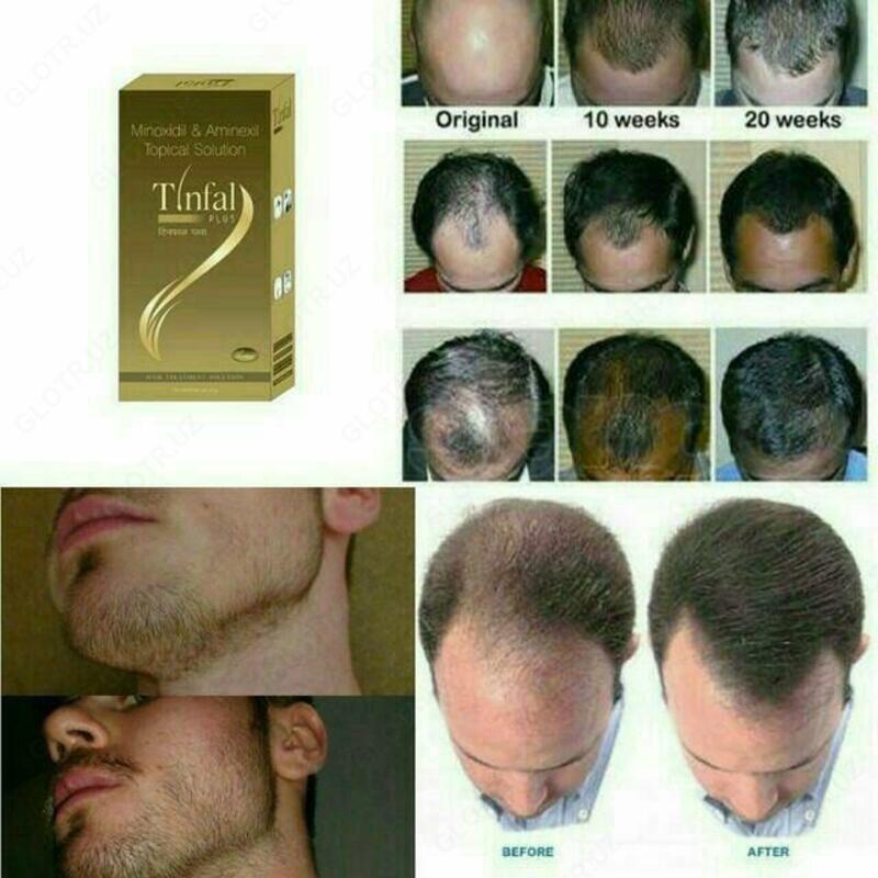 Спрей от выпадения волос Tinfal Plus