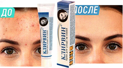 Крем от прыщей и пятен Клирвин