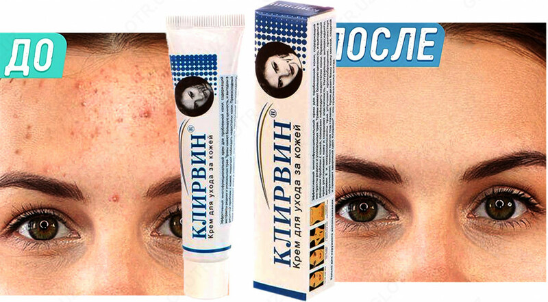 Крем от прыщей и пятен Клирвин