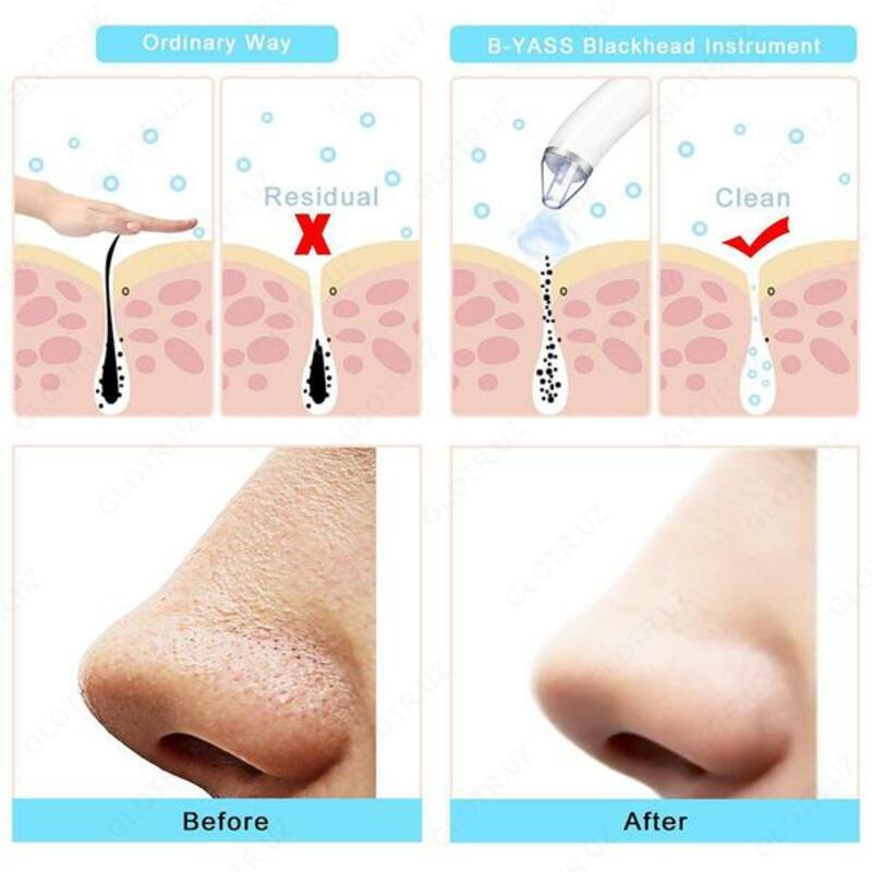 Вакуумный очиститель пор лица Blackhead Remover