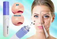 Вакуумный очиститель пор лица Derma Suction