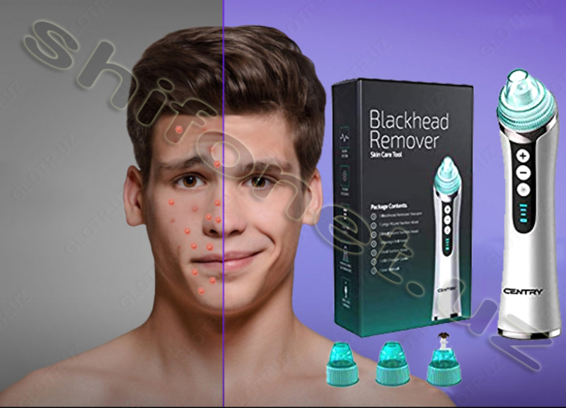 Вакуумный очиститель пор лица Blackhead Remover