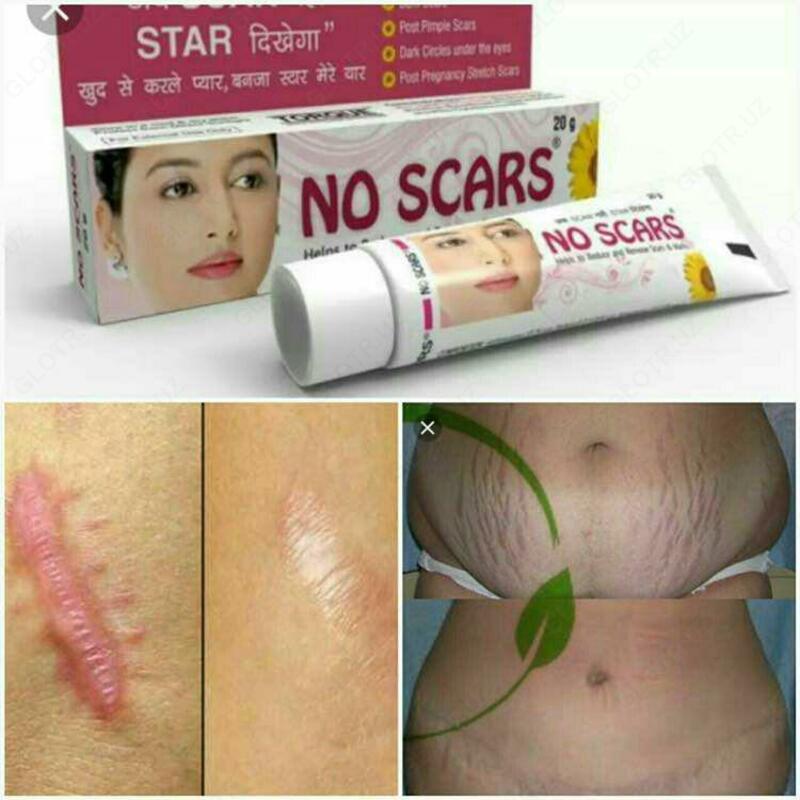 Крем для удаления шрамов No Scars