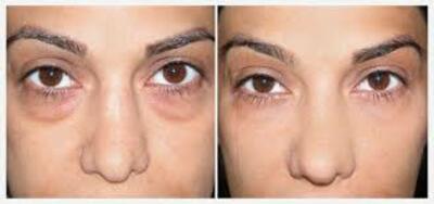 Крем для кожи вокруг глаз Skin Doctor со страусиным маслом