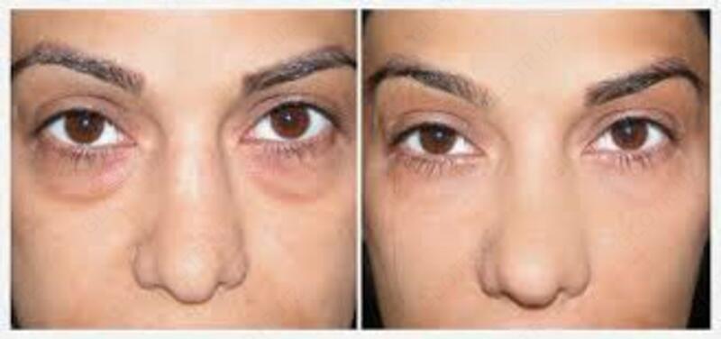 Крем для кожи вокруг глаз Skin Doctor со страусиным маслом