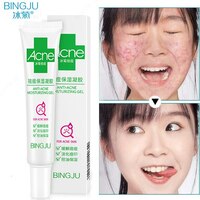 Крем от прыщей Acnovin - 120 000 сум