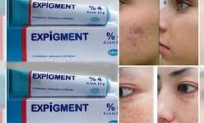 Осветляющий крем при нарушении пигментации кожи Expigment 4% (30 грамм)