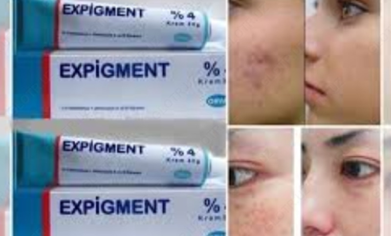 Осветляющий крем при нарушении пигментации кожи Expigment 4% (30 грамм)