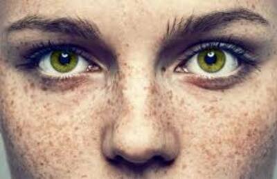 Осветляющий крем при нарушении пигментации кожи Expigment 4% (30 грамм)