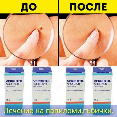 Веррутол (Verrutol) от папилом