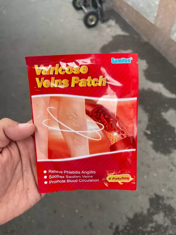 Varikoz tomirlari uchun yamoqlar