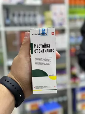 Vitiligoning oq dog'lari uchun damlamasi Vitiligoning oq dog