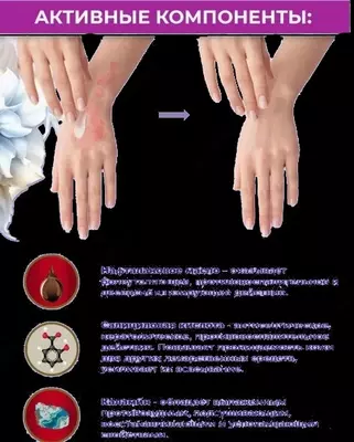 Крем-бальзам ПсориСпас