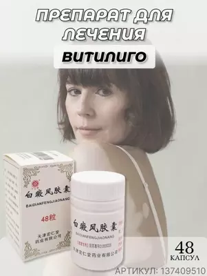 Baydianfen kapsulalari vitiligo bilan kurashish uchun tabiiy vositadir