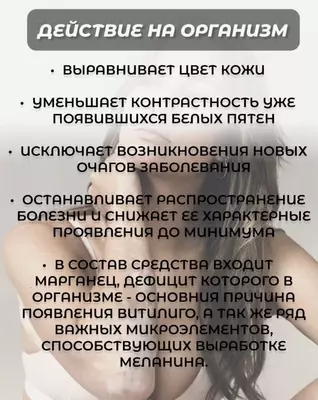 Baydianfen kapsulalari vitiligo bilan kurashish uchun tabiiy vositadir