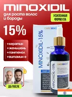 CareMinoxyl Minoxidil 15% Hair Care Serum