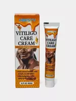 Vitiligo Care Cream HBESTY — специализированный крем для ухода за кожей