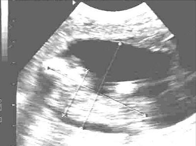 Узи сканер крс