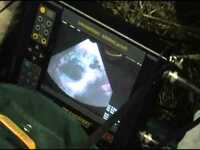 50 000 so'm Узи сканер крс