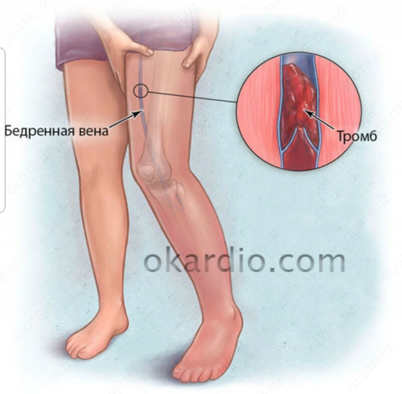 100 000 сум   Доктор Вен крем для венотонизирующий туба 75 мл.
