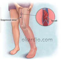 100 000 сум   Доктор Вен крем для венотонизирующий туба 75 мл.