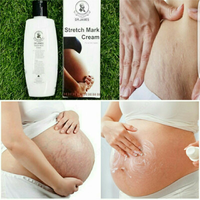 Dr. James Stretch Mark Cream / Крем для устранения растяжек Доктор Джеймс (200 мл)