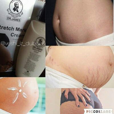 Dr. James Stretch Mark Cream / Крем для устранения растяжек Доктор Джеймс (200 мл) - 100 000 сум / шт.