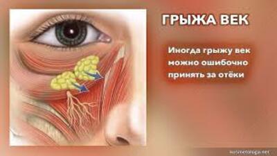 Супер крем для глаз от отеков и синяков Супер крем для глаз от отеков и синяков