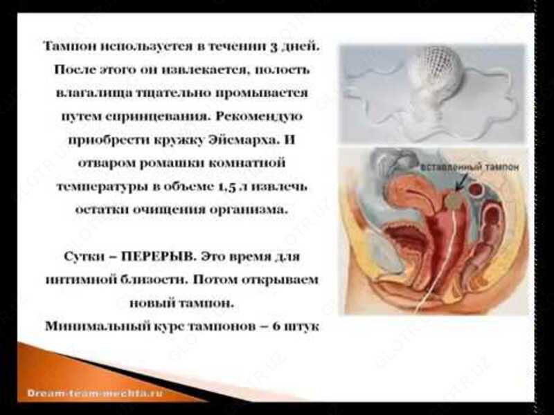 Лечебно -профилактические тампоны Beautiful Life Фитотампоны - 80 000 сум